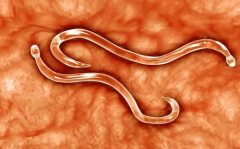 肚子有蛔虫的症状,揭秘肚子有蛔虫的常见症状与防治策略