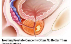 前列腺癌治疗,前列腺癌治疗策略与进展综述